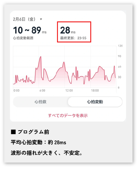 ウェアラブルデバイスを用いた日中の集中力　施術前