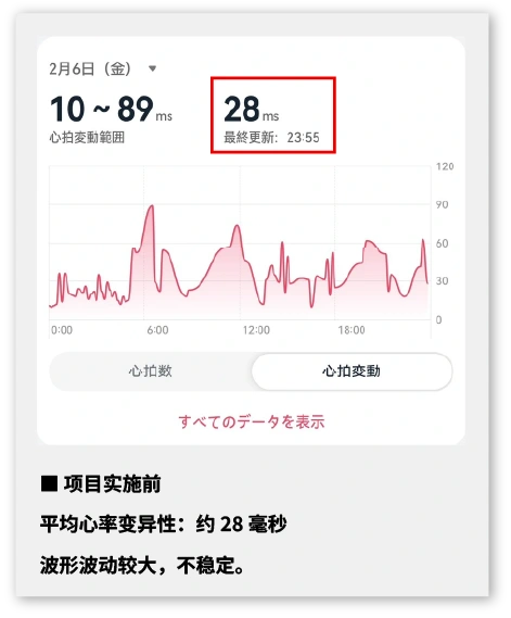 使用可穿戴设备监测日间注意力　治疗前